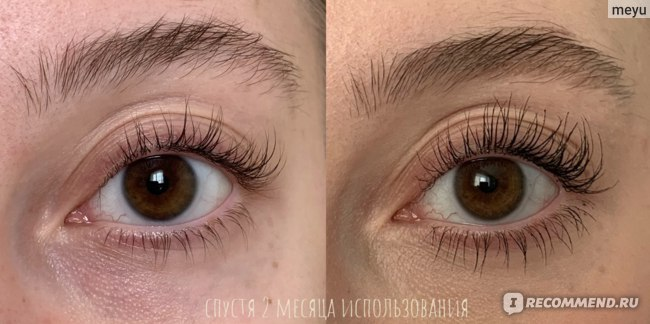 Мой потрясающий результат 