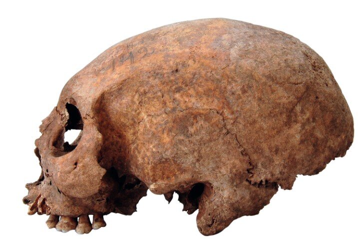 Модифицированный череп из погребения на Готланде (Хадлингбо, Хавор) / SHM/Johnny Karlsson. 2008