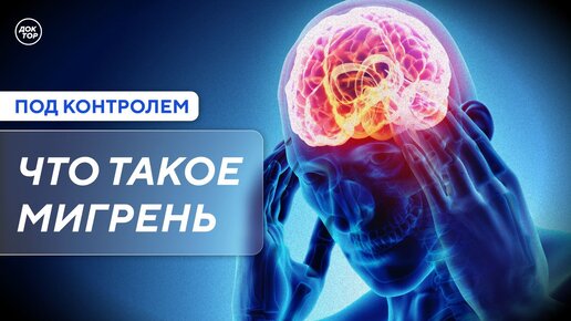 Под контролем. Что такое мигрень?