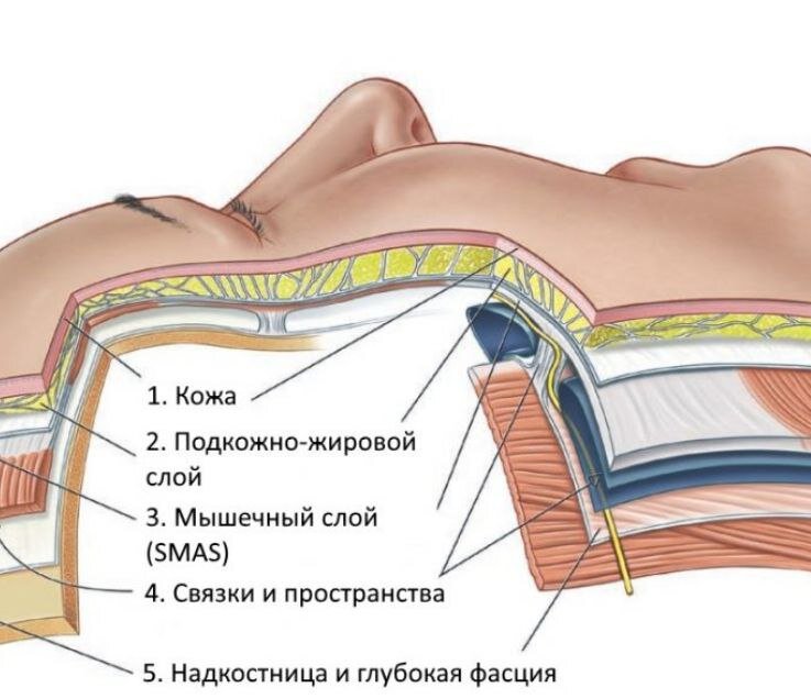 П.3 — SMAS-слой