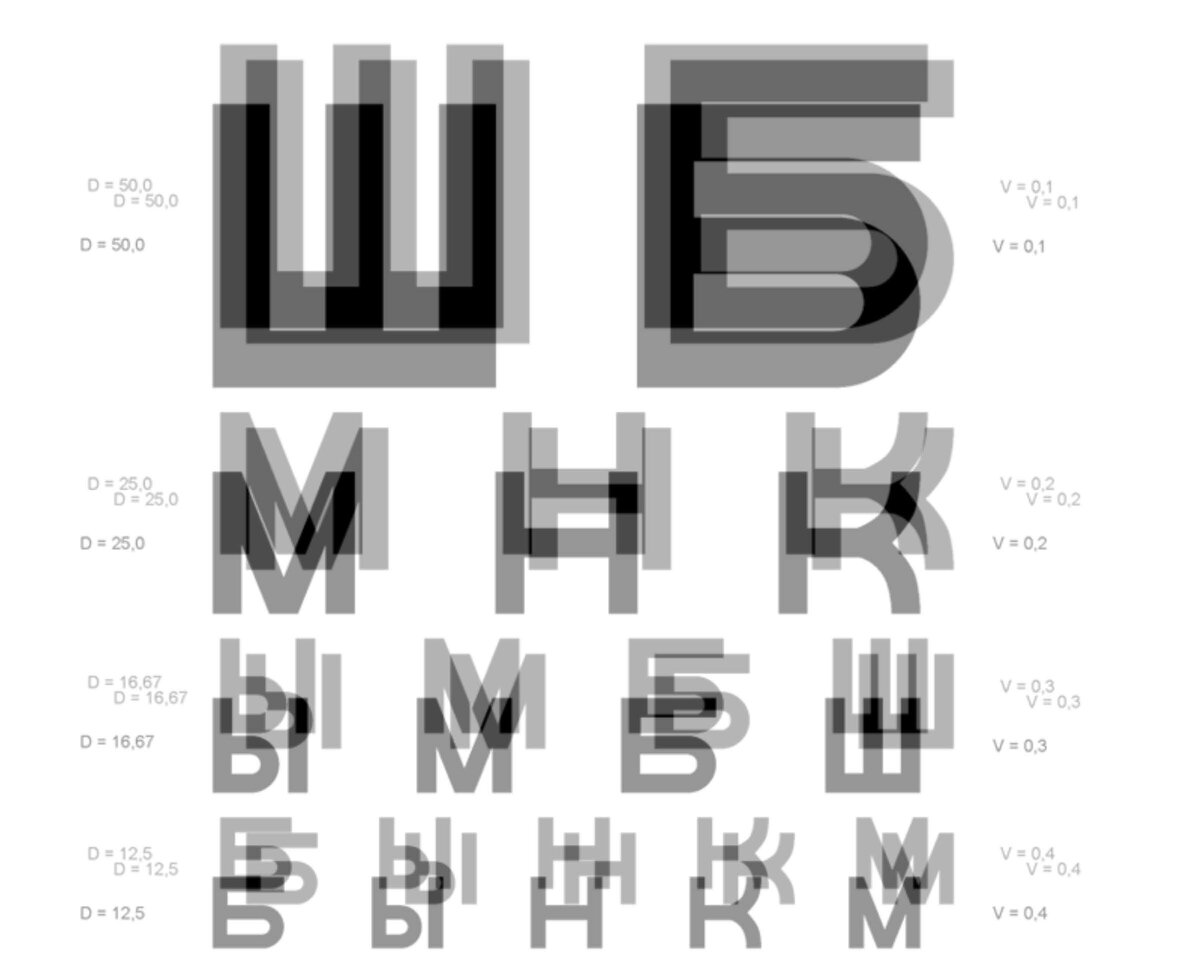 Так теперь я вижу в результате лазерной коррекции методом Smile