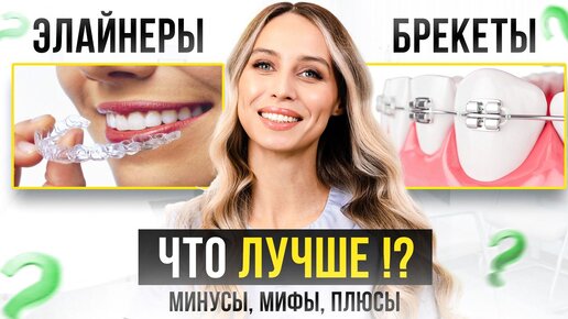 ЭЛАЙНЕРЫ или БРЕКЕТЫ? Что лучше? Все МИФЫ, плюсы и минусы. Полный выпуск об ОРТОДОНТИИ.