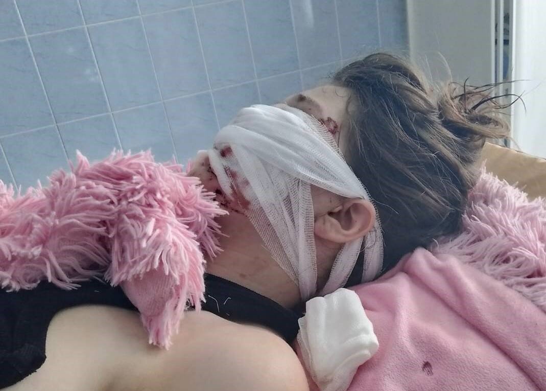 Во время трагедии отец девочки был на рынке. Дома был друг пострадавшей. Парень услышал крики и выбежал. Он оттащил собаку от ребенка и вызывал скорую помощь