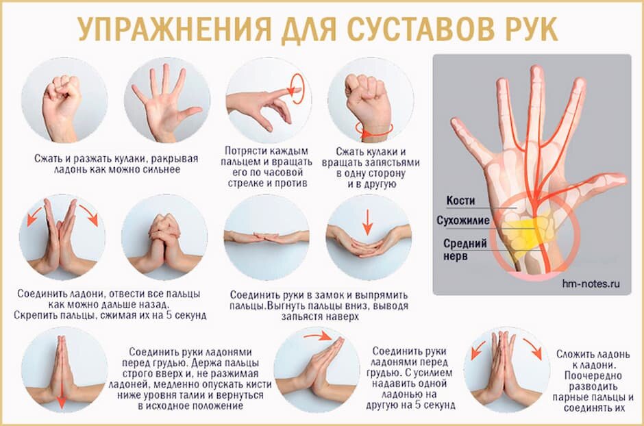 Немеют руки во время сна причины и способы решения