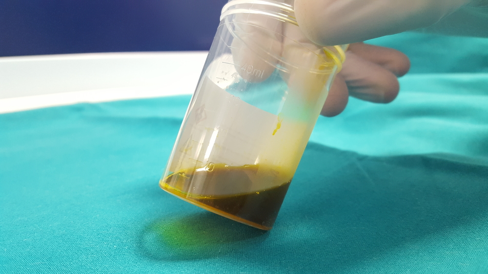 Так выглядит желчь.