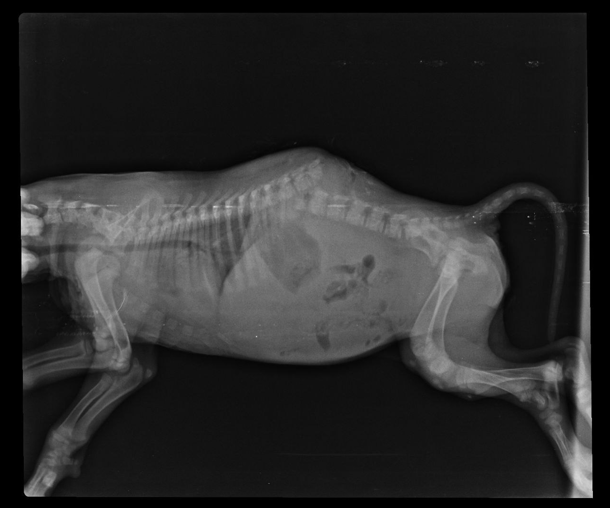 Ренген малышки. Перелом позвоночника со смещением...