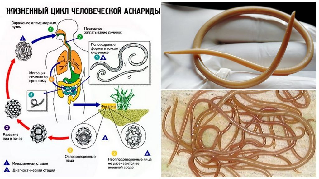 Жизненный цикл аскариды