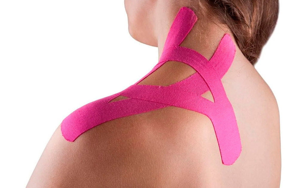 Кинезиотейпирование мышц