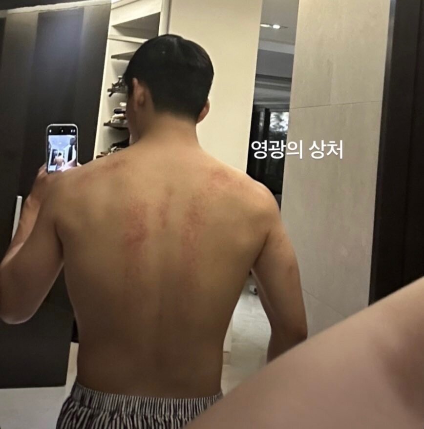 Изменения на лицо ... вернее на спине