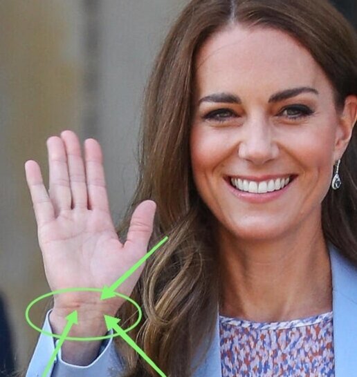 Раковые бусины на "браслетах здоровья".