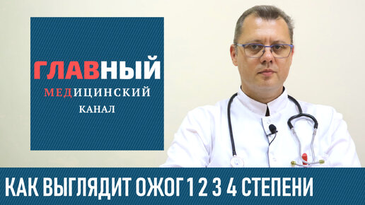 Как выглядит ОЖОГ 1, 2, 3 и 4 степени (фото 1-3). Классификация ожогов по глубине и степени тяжести