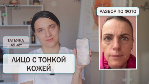 Download Video: ЛИЦО С ТОНКОЙ КОЖЕЙ. ЛУЧШИЕ ТЕХНИКИ ДЛЯ МОЛОДОСТИ И КРАСОТЫ.