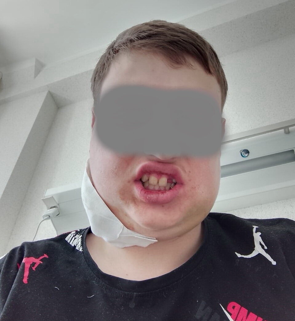 Потерпевший Кирилл (имя изменено) за месяц потерял 15 килограммов веса. Фото: Столица С 