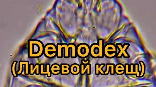 МИКРОСКОП | Оно Живет На Вашем Лице Demodex (Лицевой Клещ) #микроскоп # ...