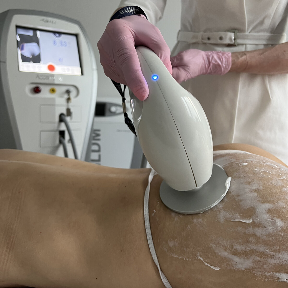 Ультразвуковой липолиз - программа Body Up на аппарате Accent в клинике косметологии GEN87