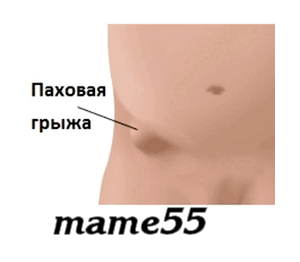 -3