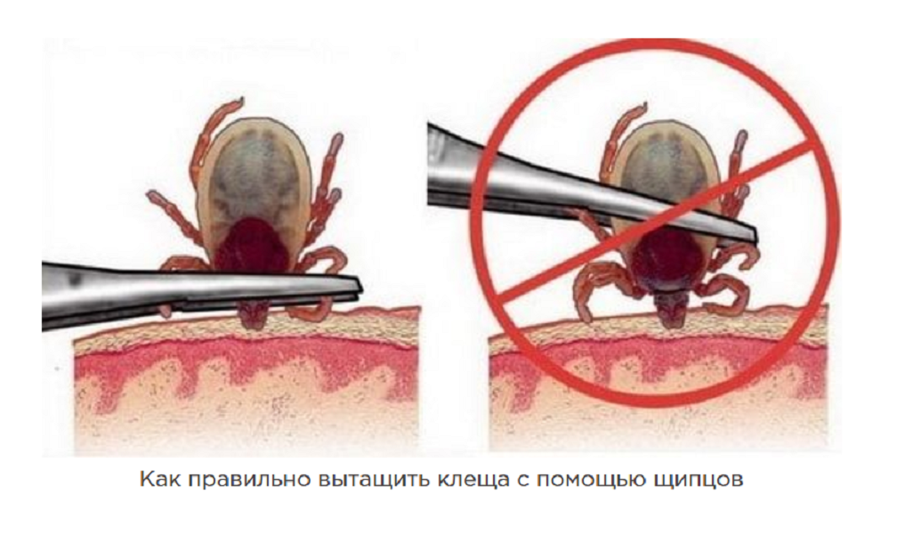  На любой прогулке в весеннем и летнем лесу нас подстерегают опасные и прыткие хищники, которые только и ждут момента, чтобы укусить. Как вы догадались, речь пойдет о клещах.-2