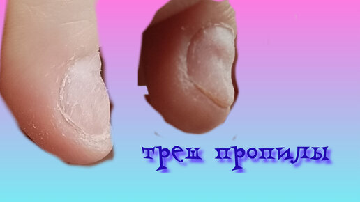 Треш. Испортили ногти в салоне#naila#треш#трендыманикюрв