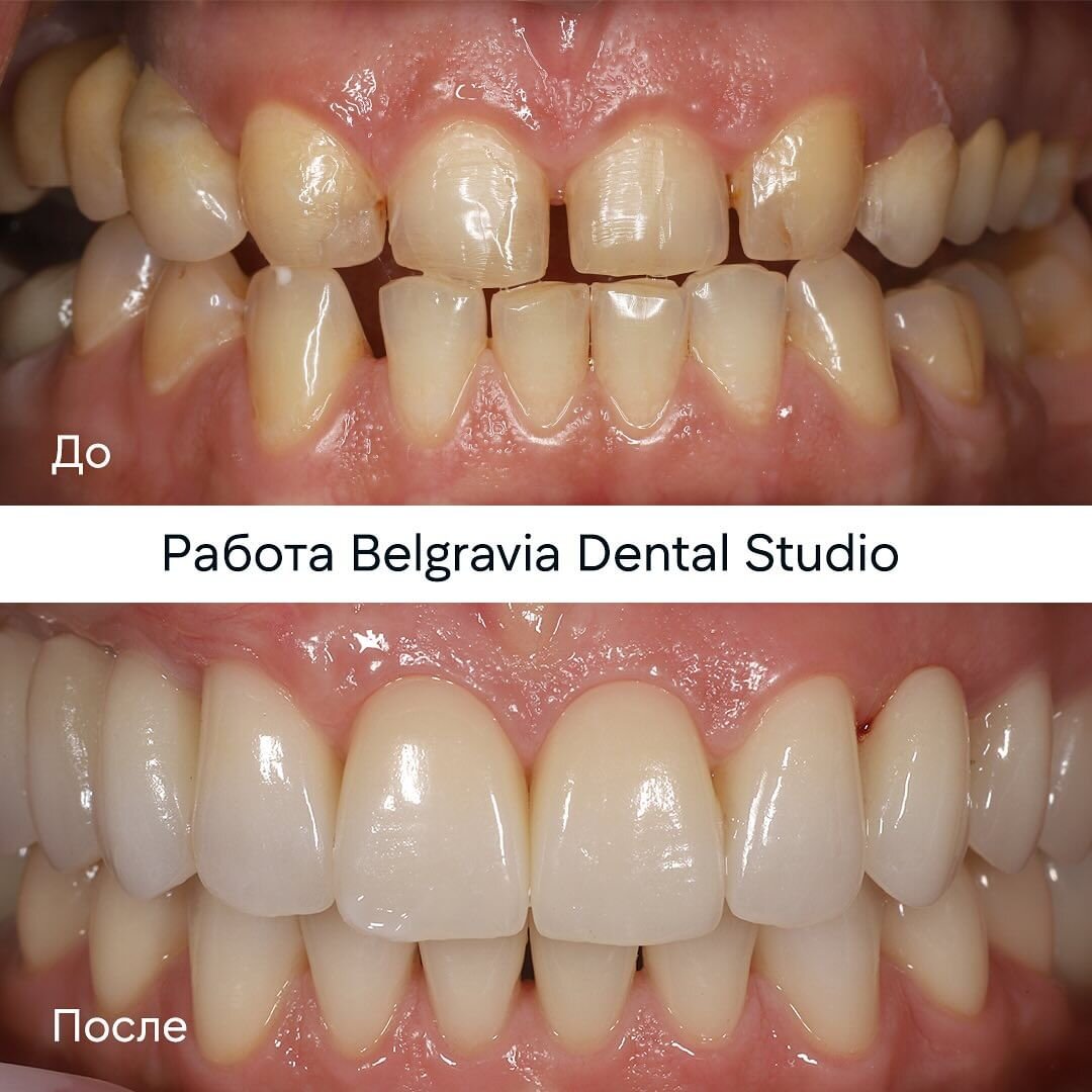 Случай из практики: командная работа | Стоматология Belgravia Dental Studio  | Дзен