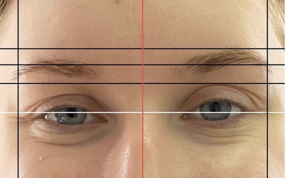 Моя ассиметрия