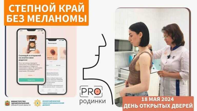   В Оренбуржье 18 мая впервые пройдет акция «Степной край без меланомы» Кристина Просвиркина
