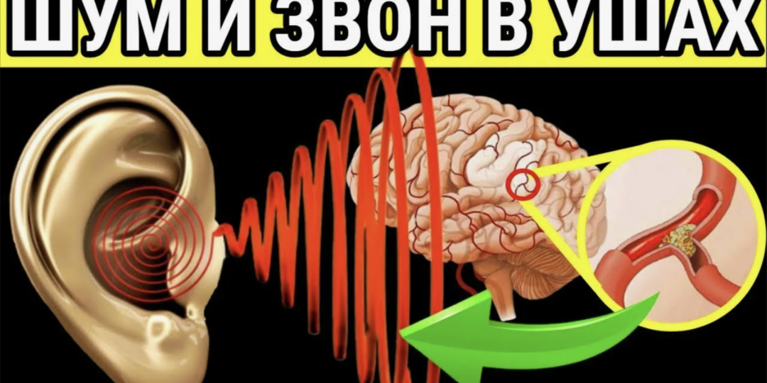 Почему возникает шум в ушах? Что делать, если в одном или обоих ушах шумит, пищит или шипит