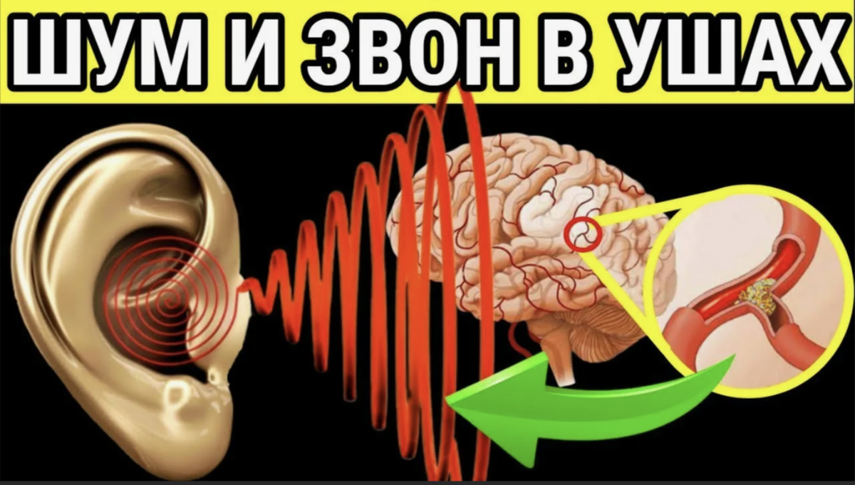 Тахикардия: симптомы, причины, виды, диагностика, последствия и методы лечения в «СМ-Клиника»