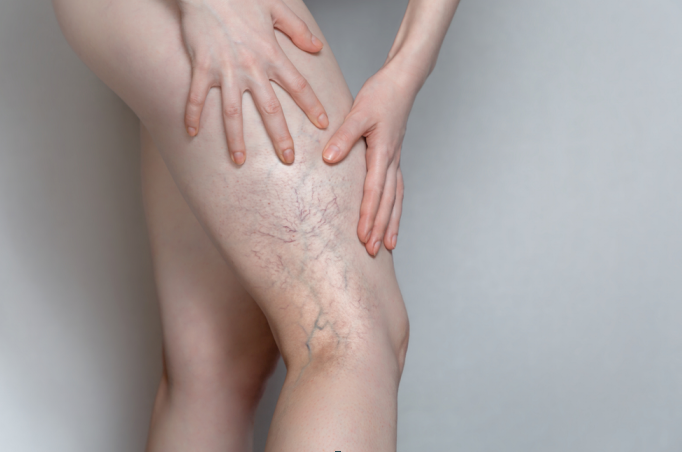 Больно, но можно просто устранить без лекарств.