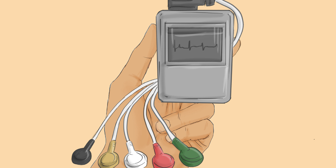 Холтер на сердце: как он работает и кому нужен? Показания, правила ношения и результаты — объясняет врач