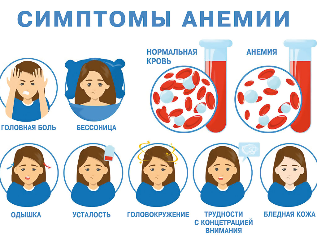 Повышаем работоспособность. Почему после сна мы ощущаем усталость? |  Социальный проект 