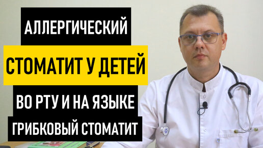 Аллергический Стоматит у Детей. Грибковый стоматит у ребенка и новорожденных