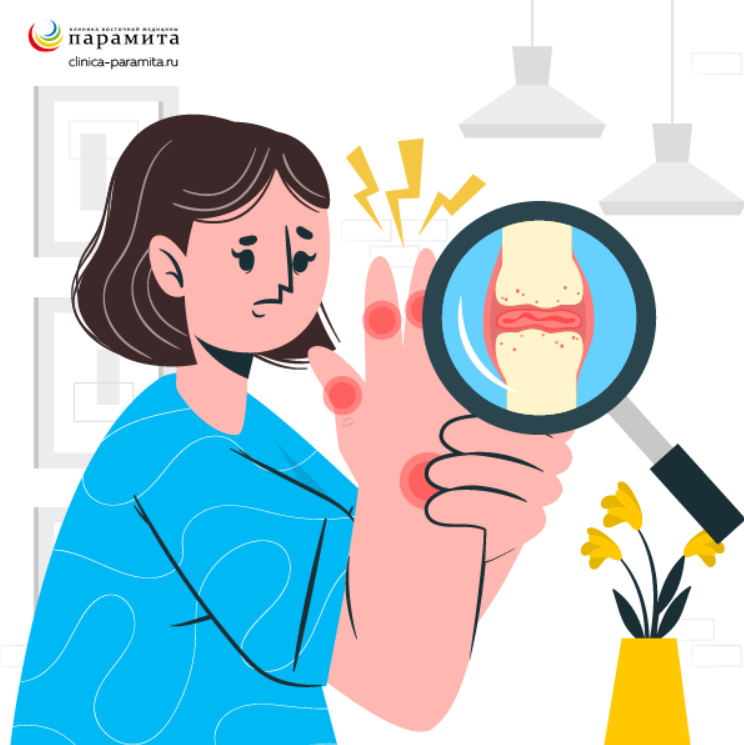 Ревматоидный артрит