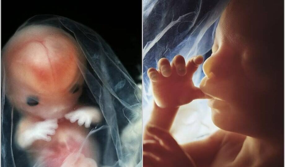 14 революционных снимков 1960-х годов, которые показывают рождение человека