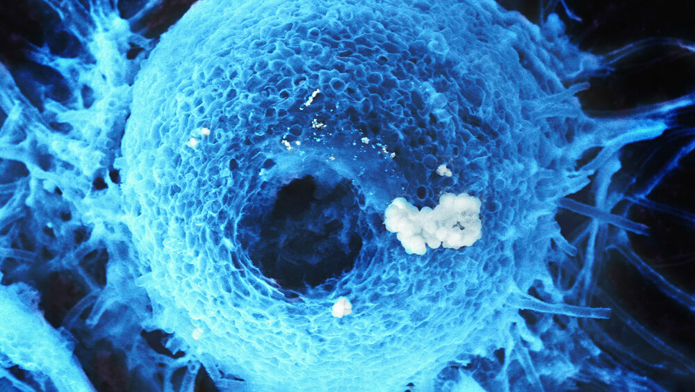   Фото: Фукина Диана , Плодовое тело гриба Chaetomium globosum под сканирующим электронным микроскопом