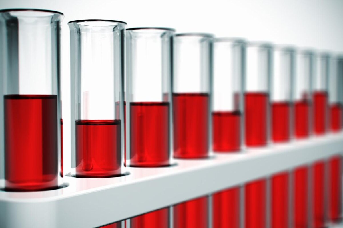 Oleksiy Mark/Shutterstock📷Кровь состоит из эритроцитов, лейкоцитов и тромбоцитов, содержащихся в плазме