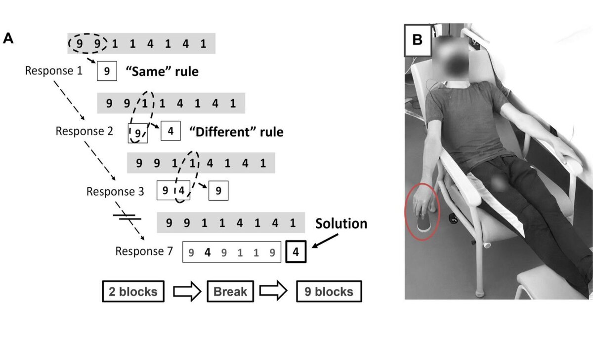 Фото: Oudiette et al.A. Правило «для одинаковых»: если две последовательные цифры одинаковы, ответом будет эта цифра (например, 4–4, ответ: 4). Правило «для разных»: если они разные, результатом будет оставшаяся третья цифра (например, 1–4, ответ: 9). B. Участник эксперимента во время паузы