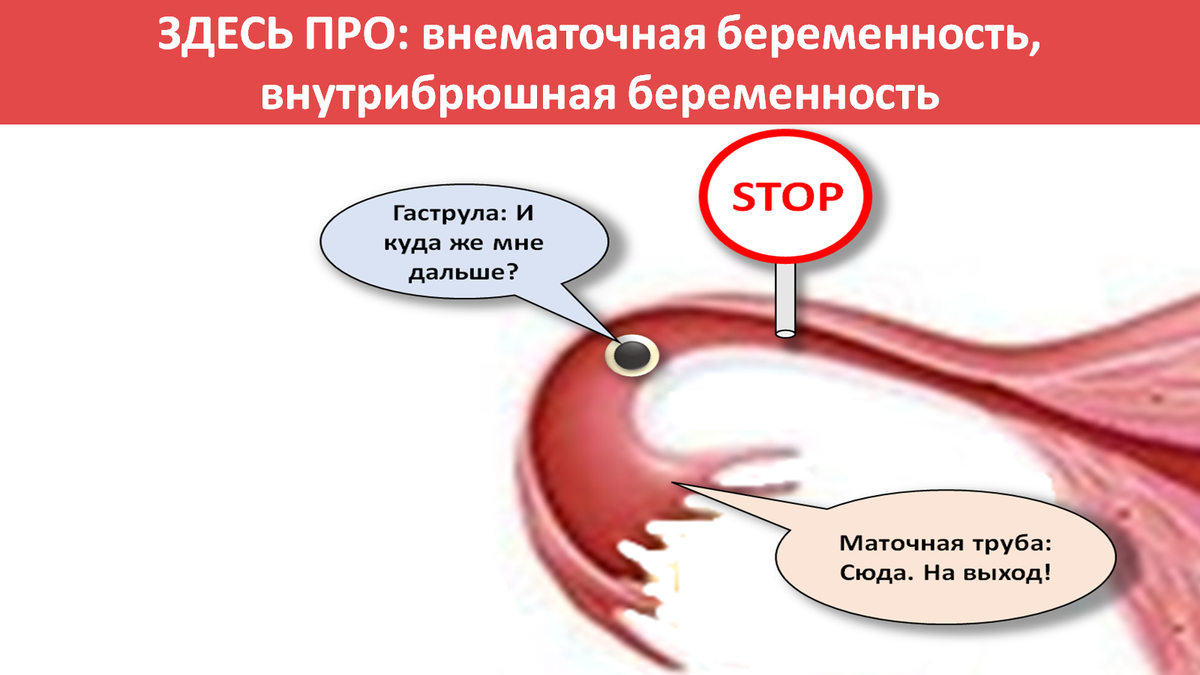 Продолжаем обсуждать статью: Вот один из комментариев к ней: "А как  оплодотворенная яйцеклетка попадает в брюшную полость?