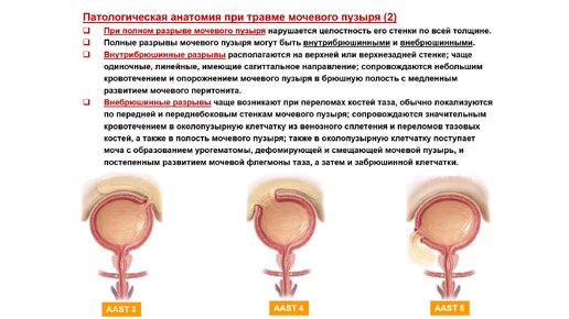 Ультразвуковая диагностика (УЗИ). Доктор Иогансен. Выпуск 101. Травматические повреждения мочевого пузыря. Часть 1.