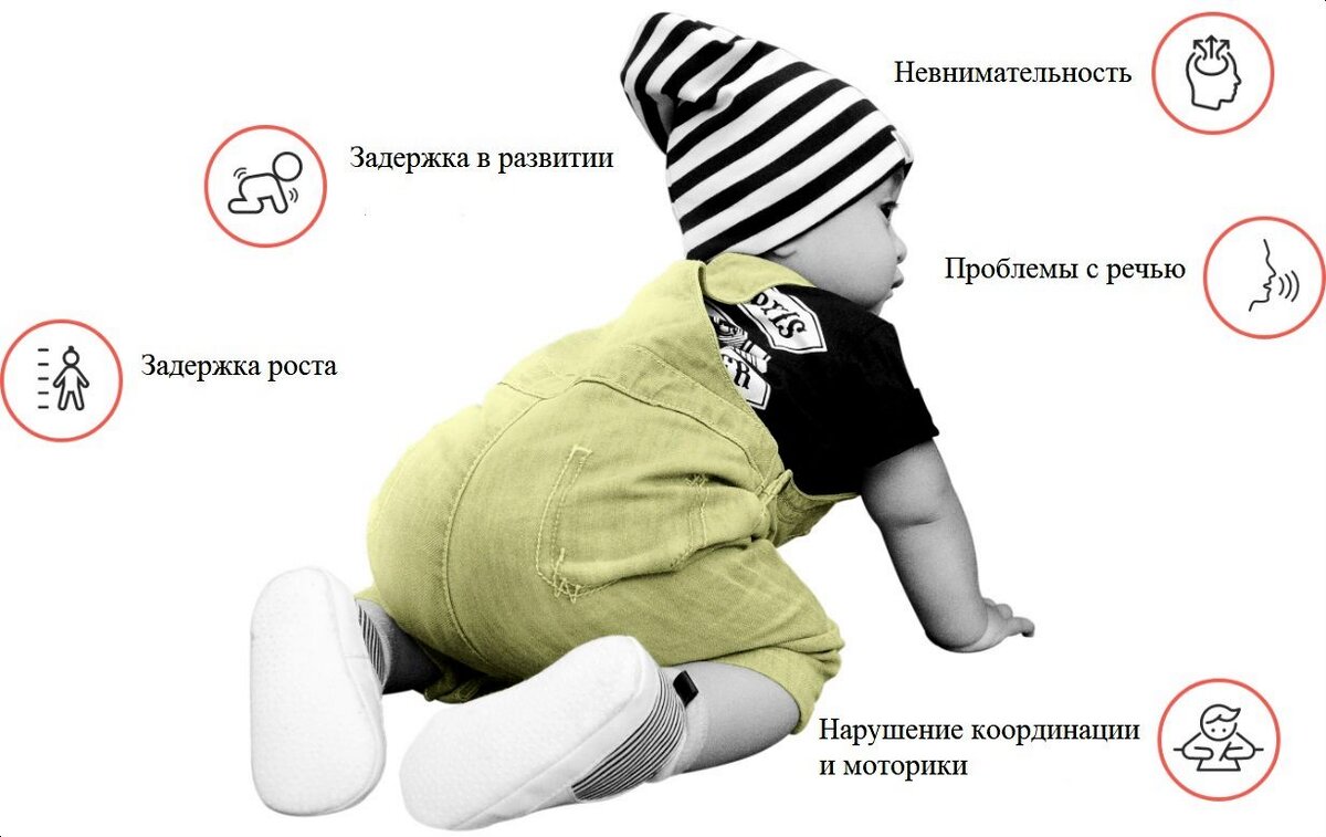 Возможные нарушения при галактоземии