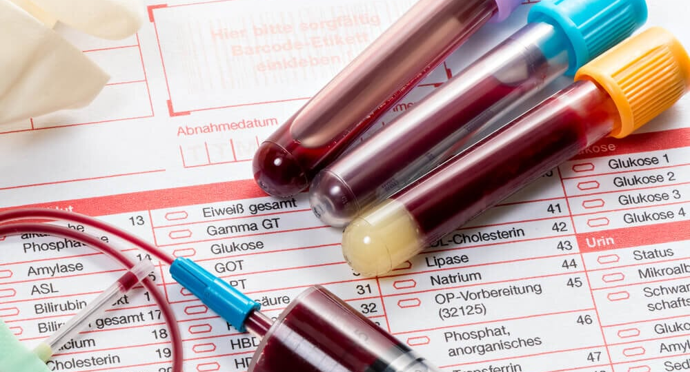 Как найти аллергию с помощью одного анализа крови?