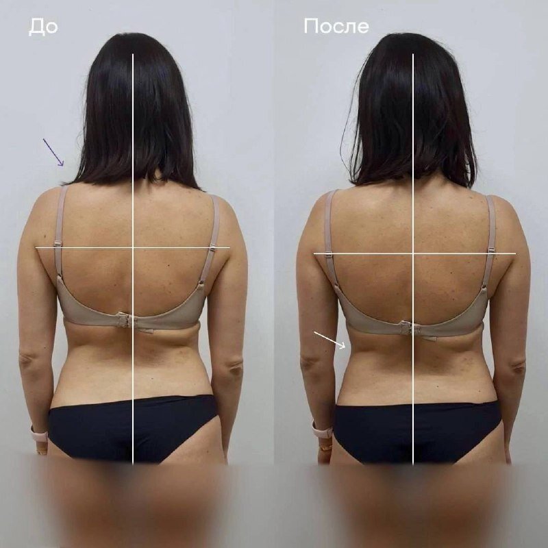 Клиника "Остео Лайт"