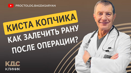 Киста копчика. Как залечить рану после удаления эпителиального копчикового хода (ЭКХ)?