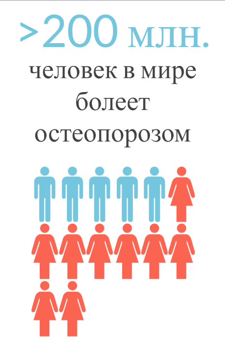 Статистика остеопороза