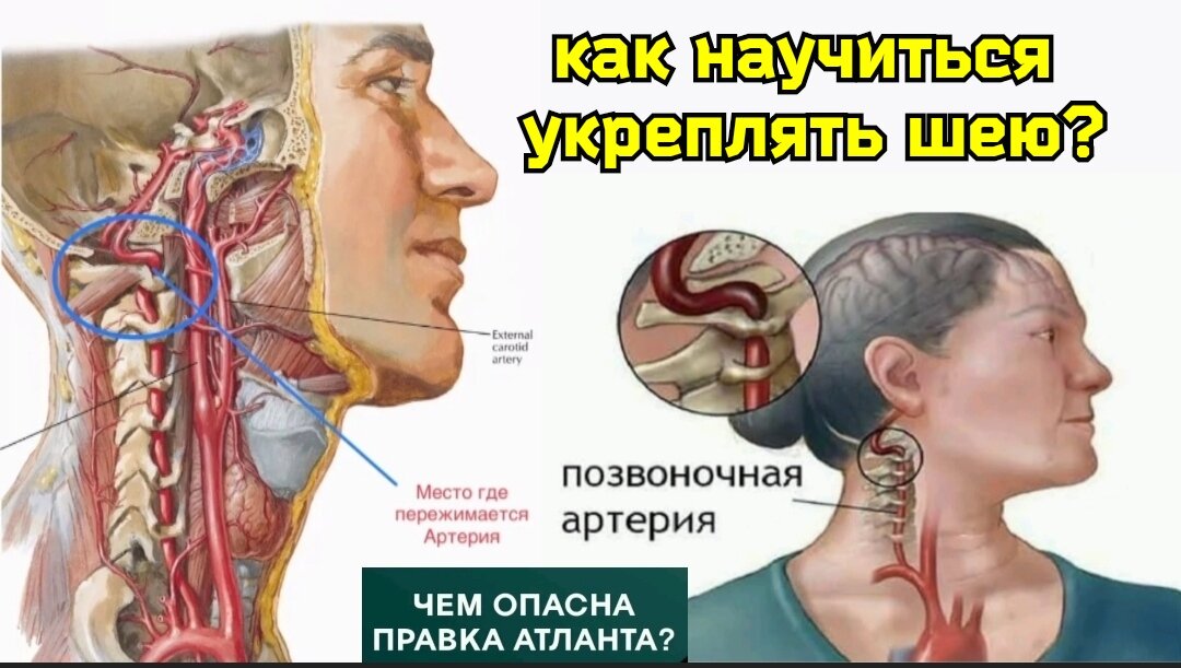  Хотите укрепить шею и улучшить работу мозга? Тогда НЕ делайте правку атланта. Это очень опасная процедура, особенно если проводится неграмотными "специалистами".