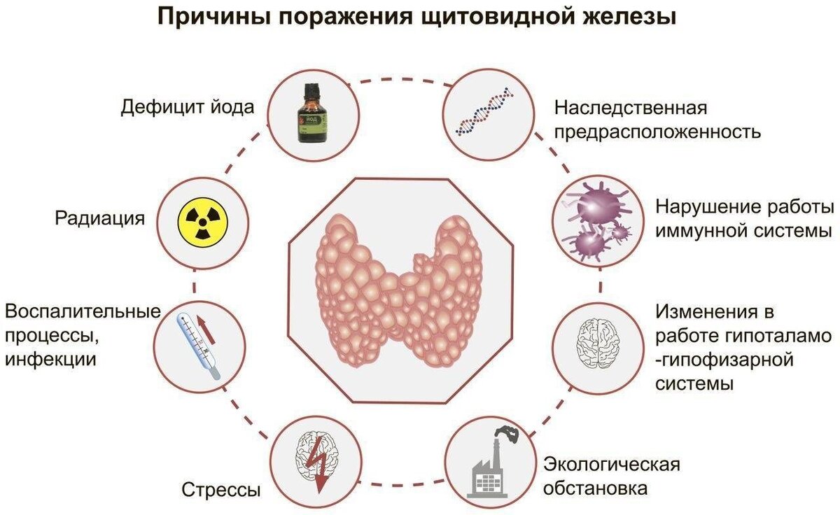 25 МАЯ – Всемирный день щитовидной железы | Городская поликлиника №8 ДЗМ |  Дзен