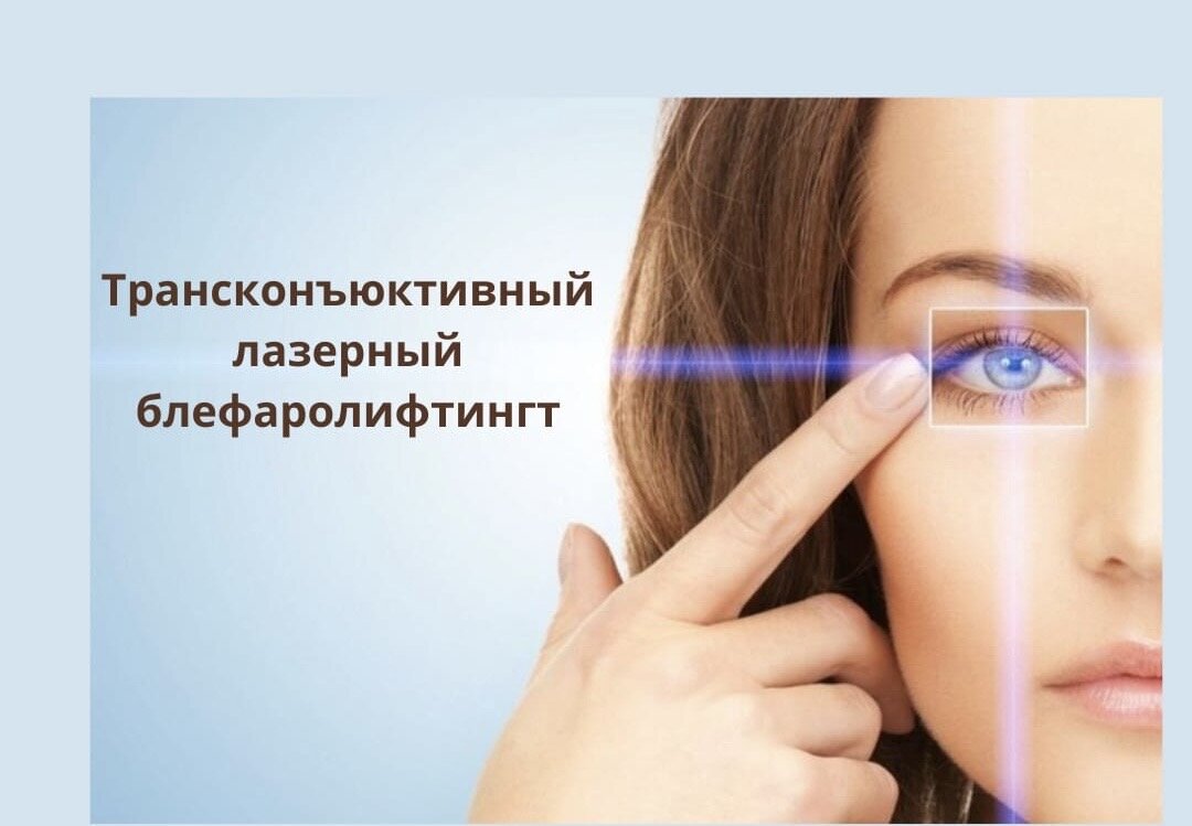 Трансконъюктивный лазерный блефаролифтинг)