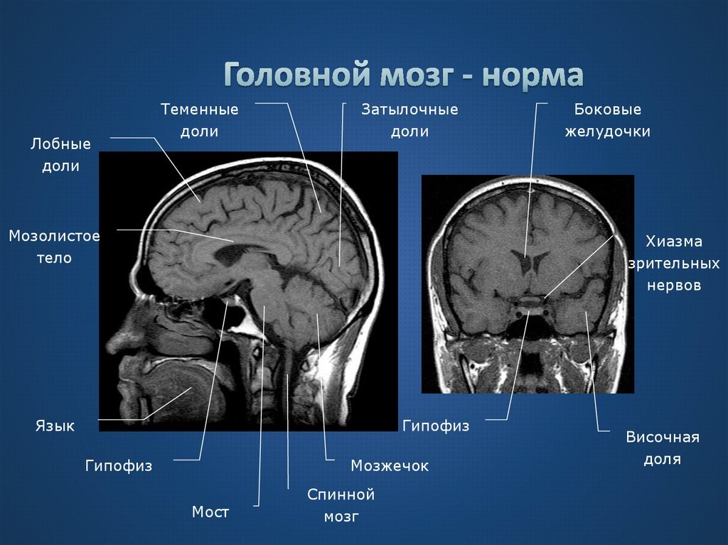 Яндекс Картинки