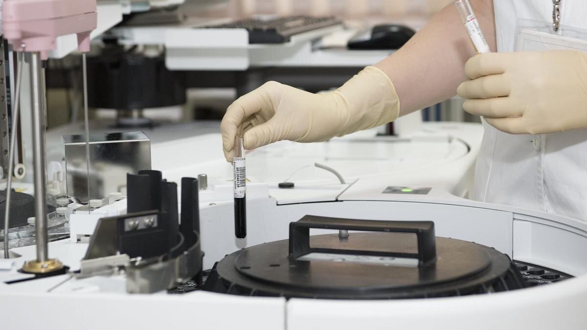    Людям важно проверять уровень сахара в крови. Фото: piqsels