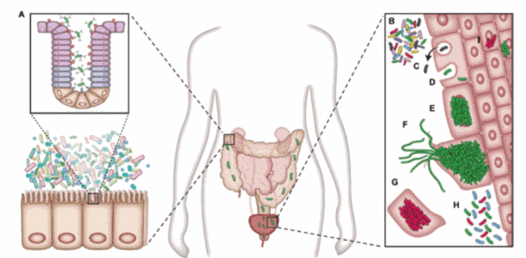 UPEC обитают в кишечнике, но могут попасть в мочевыводящие пути, где затем вторгаются в клетки хозяина. Иллюстрация: Tamadonfar K.O., et al./Microbiology Spectrum, 2019