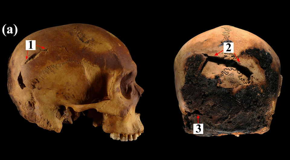   Rosario Guimarey Duarte et al. / International Journal of Osteoarchaeology, 2024